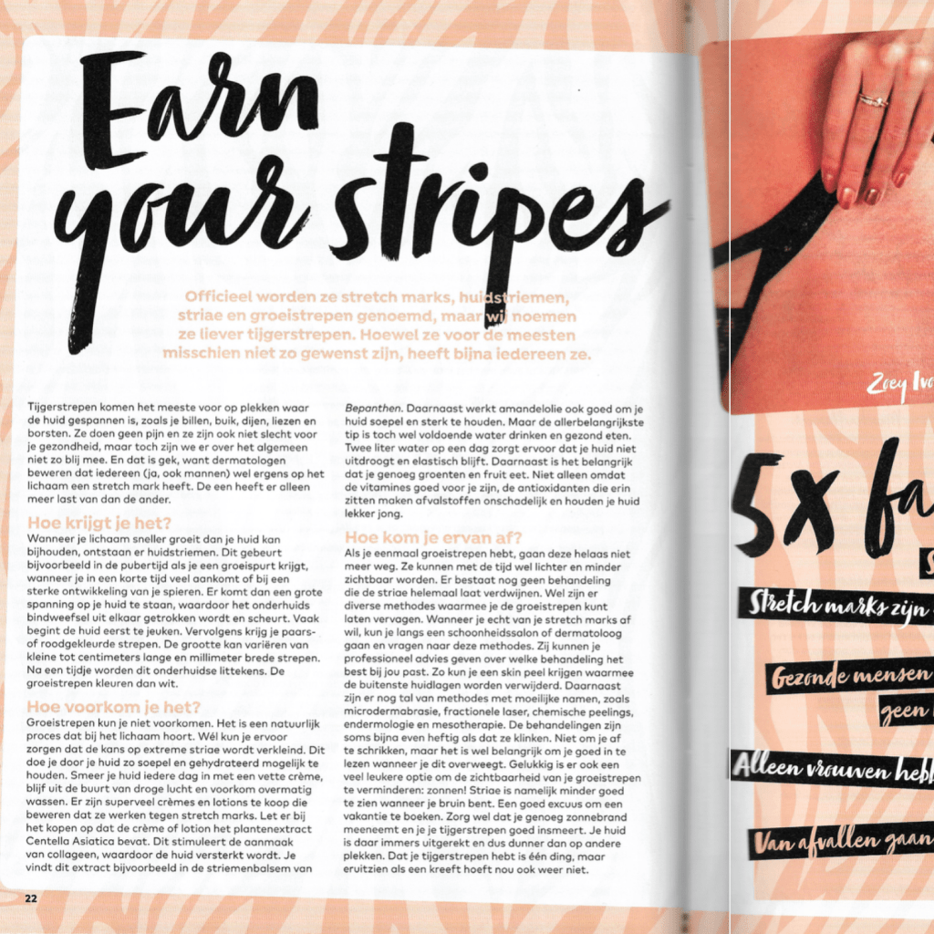 striae GIRLZ magazine